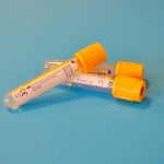 Blood samples prepared for a feline diagnostic panel